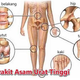 Illustration for article titled Obat Tradisional Penyakit Asam Uratem/emem/em